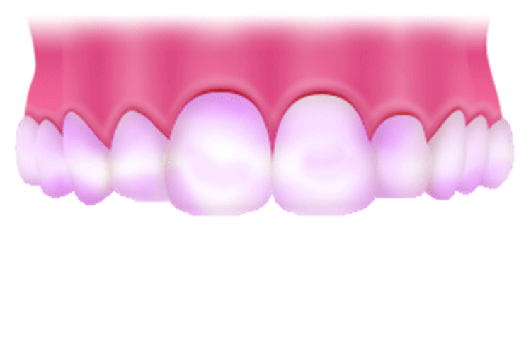 染め出しチェック