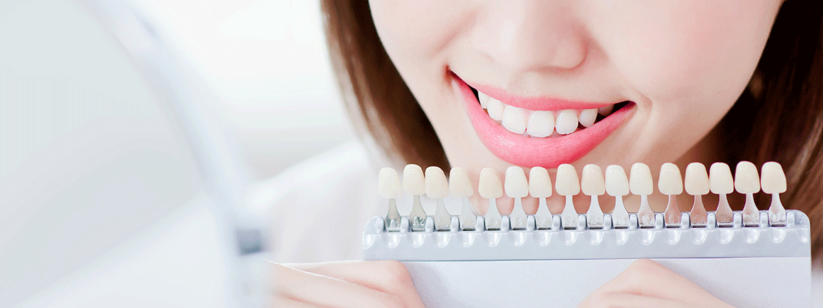 歯をきれいにすることで、あなたはもっときれいになれる