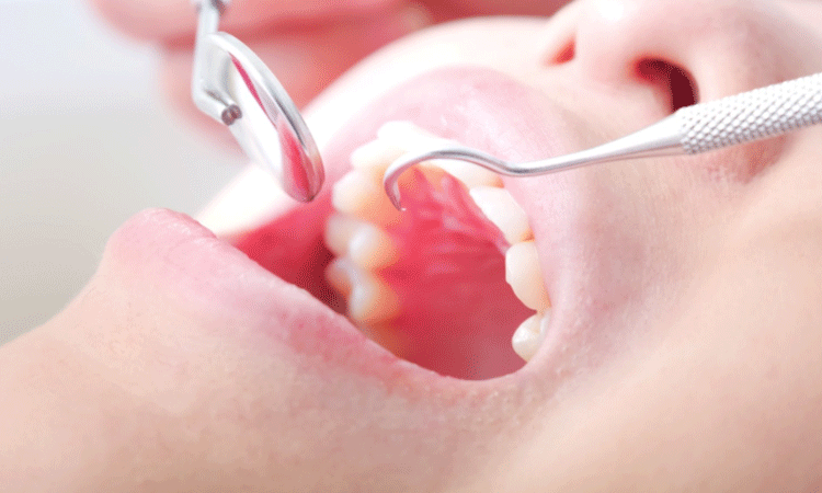 審美歯科・ホワイトニング