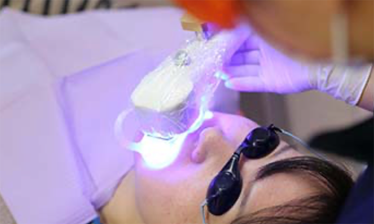 ホワイトニング当日