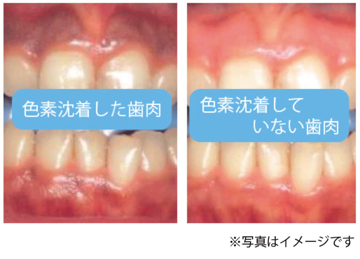 画像のタイトル